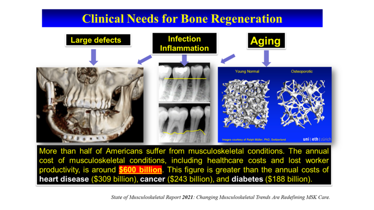 Clinical Needs for Bone Regeneration